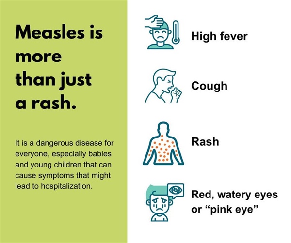Measles is serious for people of all ages, but some groups are more likely to have complications with the virus: