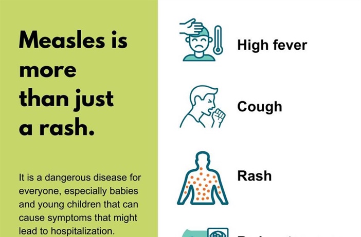 Measles is serious for people of all ages, but some groups are more likely to have complications with the virus: