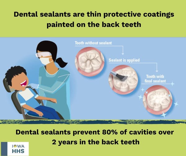 🦷 Dental Sealants: A Simple Way to Protect Smiles 🦷